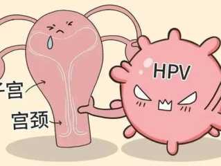 隐瞒HPV致女友感染男子被判赔偿1.5万元
