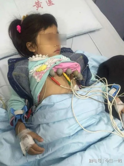 网购化学品做实验，11岁男孩重伤，悲剧的警钟